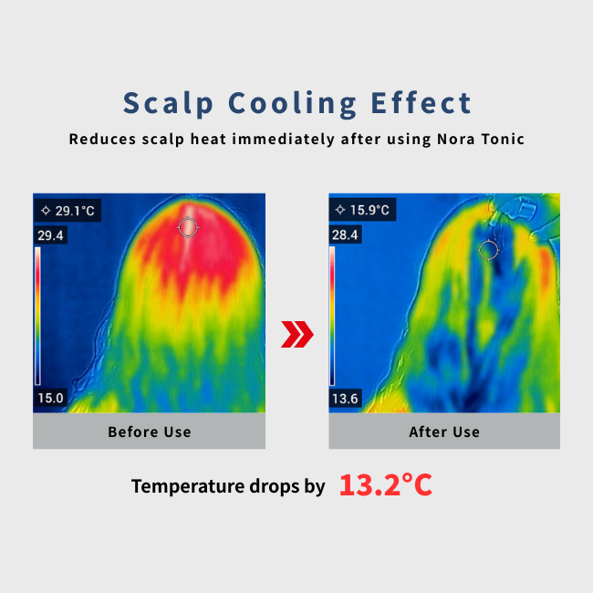 Tonic pentru scalp NOLA [4]
