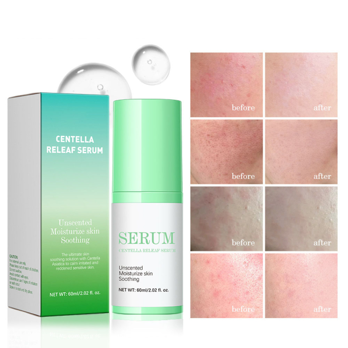 Tratament Facial Coreean Cu Centella Asiatica [6]