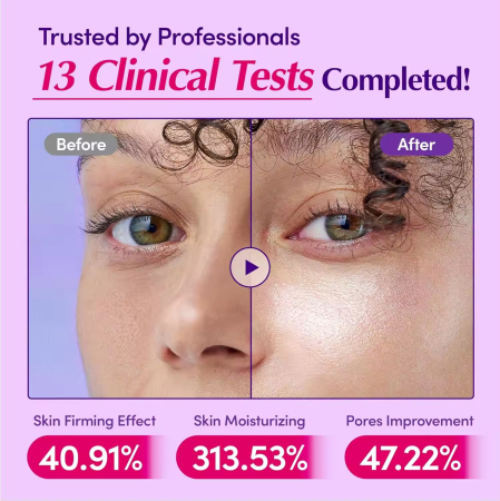 Ser Iluminator Cu Vitamina C [2]