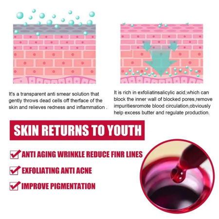 Ser Facial Pentru Peeling Cu Aha 30% Si Bha 2% [2]