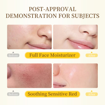 Mooyam Toner Cu Orez Iluminator Și Antioxidant [3]