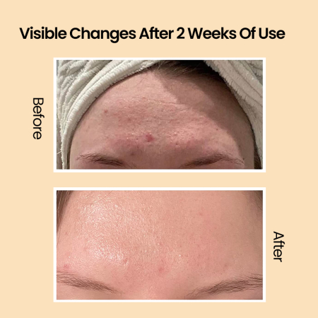 Crema faciala anti-imbatranire cu mucina de melc [4]