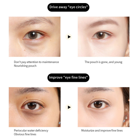 Patch-Uri Pentru Ochi Cu Hidrogel De Alge Marine Si Colagen Natural Pur [1]