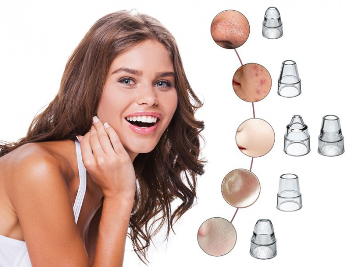 Aparat pentru curatarea porilor si indepartarea punctelor negre Beper P302VIS001 [6]