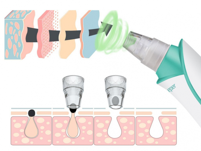 Aparat pentru curatarea porilor si indepartarea punctelor negre Beper P302VIS001 [5]