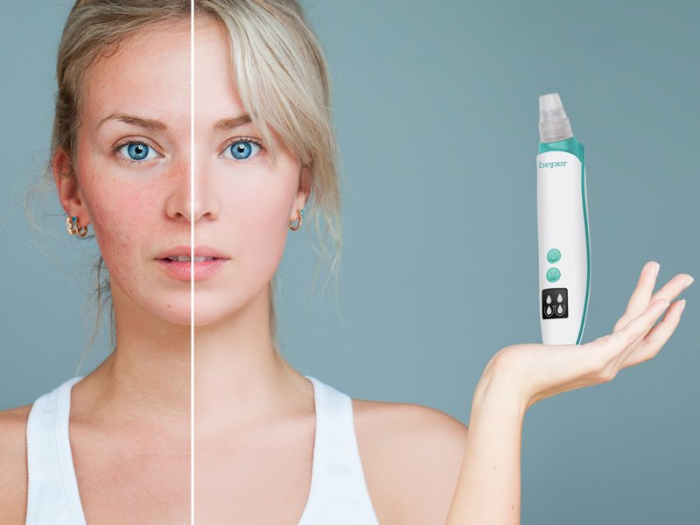 Aparat pentru curatarea porilor si indepartarea punctelor negre Beper P302VIS001 [8]