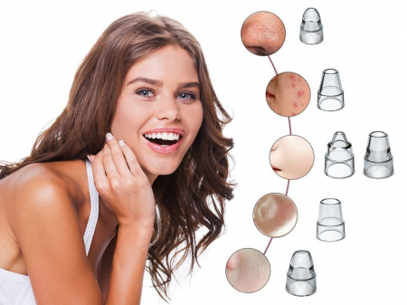 Aparat pentru curatarea porilor si indepartarea punctelor negre Beper P302VIS001 [5]