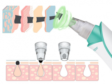 Aparat pentru curatarea porilor si indepartarea punctelor negre Beper P302VIS001 [4]