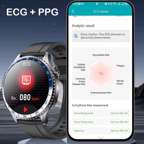 Ceas SmartWatch ZENARK® X-MT 9 PRO, Ecran AMOLED Ultra HD 4K, Estimare Glicemie, ECG, Ritm cardiac 24H, Somn, SpO2, MET, HRV, Tensiune arteriala, Respiratie, Componente sange, Evaluare rapida 30 Sec, Notificari, Apel HD, SMS, Lanterna/SOS LED, Negru [2]