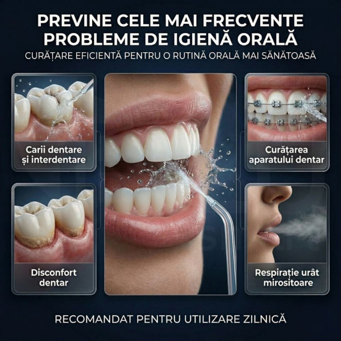 Irigator Oral Profesional cu Sterilizare UV pentru Duș bucal [3]