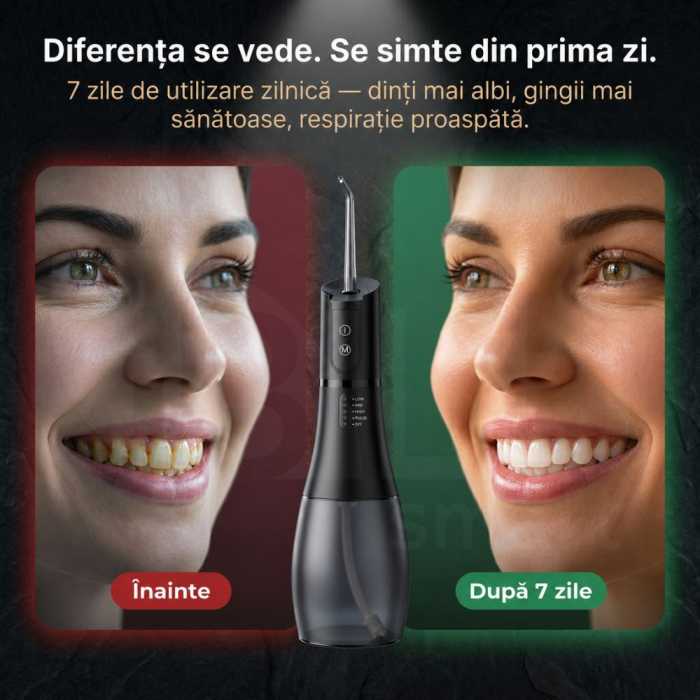 Irigator Oral Profesional pentru Duș Bucal cu Rezervor Detașabil, Portabil, 6 Capete, Negru [2]