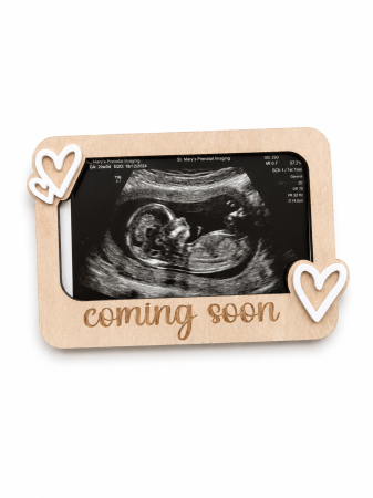 Magneți - Magnet Prima Fotografie „Coming Soon”