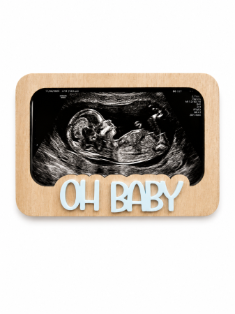 Magneți - Magnet Prima Fotografie Oh Baby