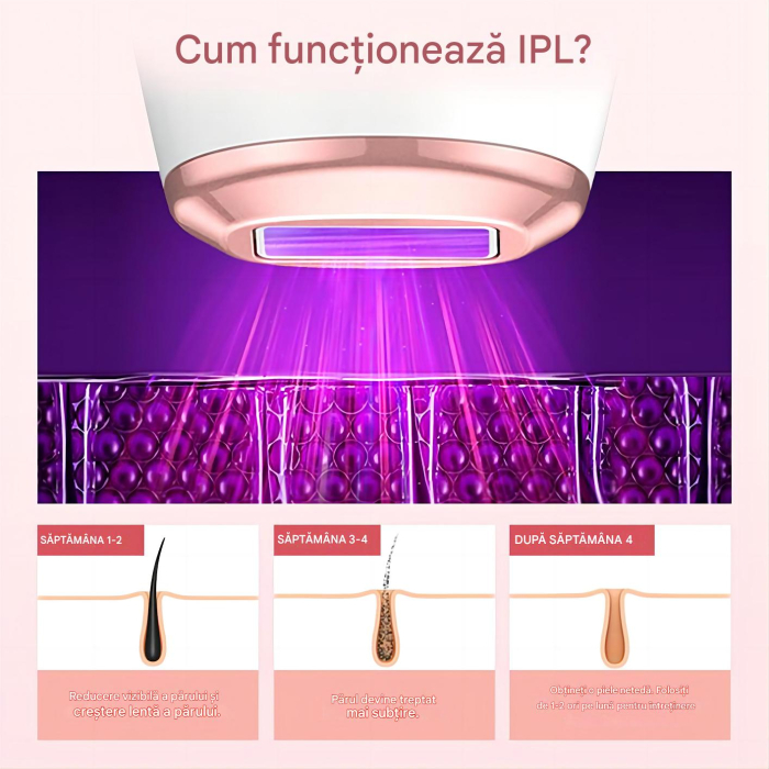 Epilator IPL OIAO E69-HR004, Pentru Epilare Definitiva Fara Durere, Tehnologie IPL, 5 Trepte De Intensitate, Senzor Piele SmartSkin, Mod Automat, Cu Afisaj, 990.000 de Pulsati [15]