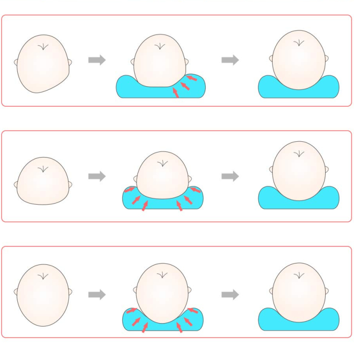 Perna bebelusi cu 2 huse contra plagiocefaliei pentru formarea capului, Albastru [5]