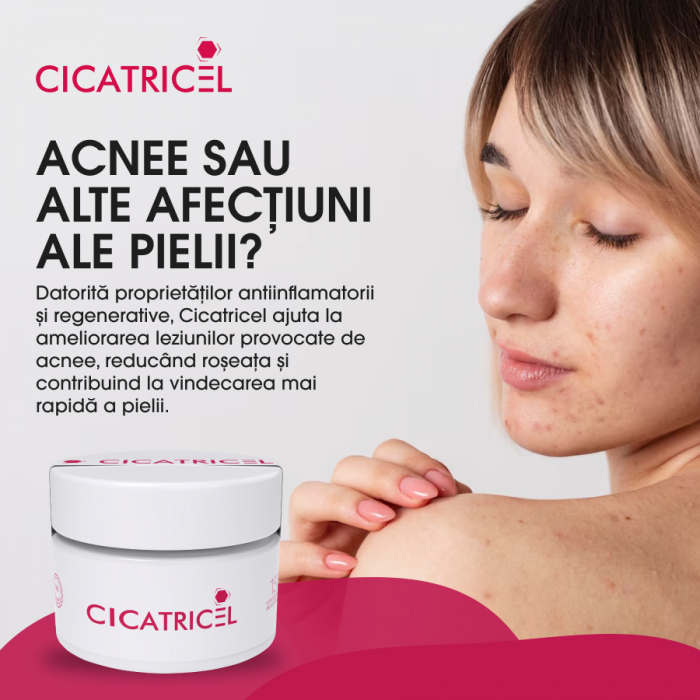 Crema Naturista Cicatricel - Vindecare Rapida pentru Tatuaje, Rani Acute, Arsuri Solare, Julituri, Leziuni, Vanatai, Taieturi, Iritatii, Cicatrici, 50ml [15]
