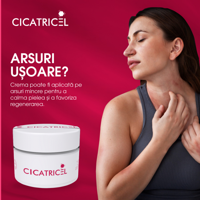 Crema Naturista Cicatricel - Vindecare Rapida pentru Tatuaje, Rani Acute, Arsuri Solare, Julituri, Leziuni, Vanatai, Taieturi, Iritatii, Cicatrici, 50ml [9]