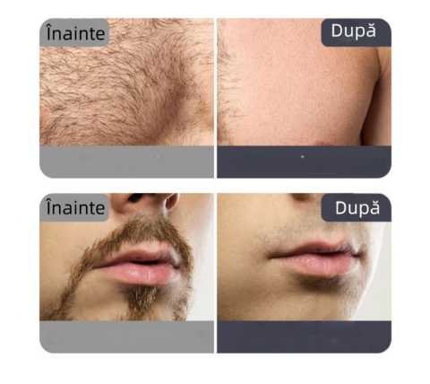 Aparat de tuns pentru zone sensibile cu accesorii pentru față, bikini și axile [8]