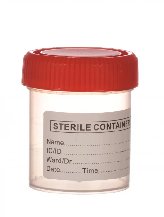 Coprocultoare si Urocultoare - Recipient urocultura steril, 60ml - Euromed