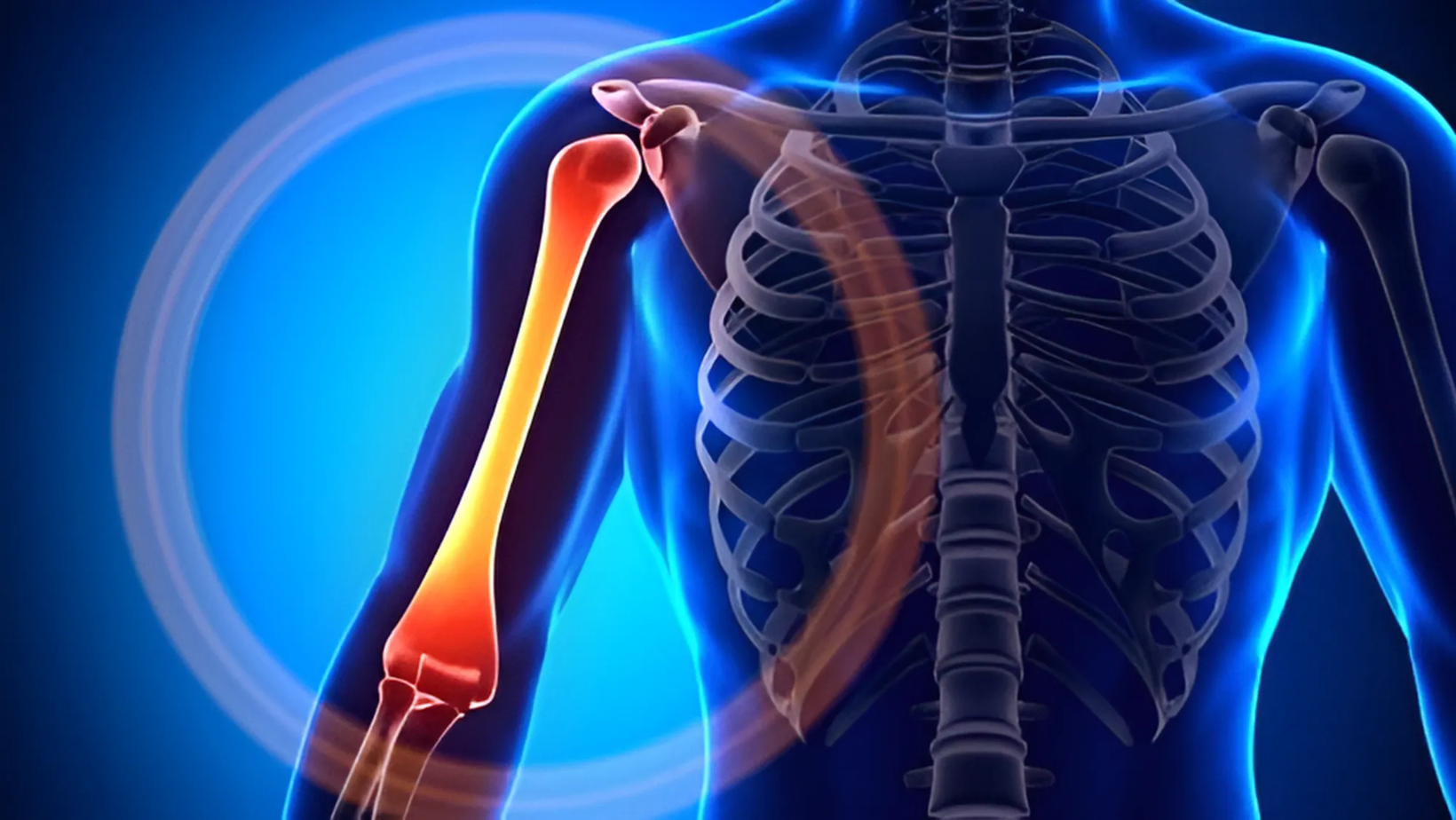 Fractura de Humerus: Ghid Complet și Detaliat