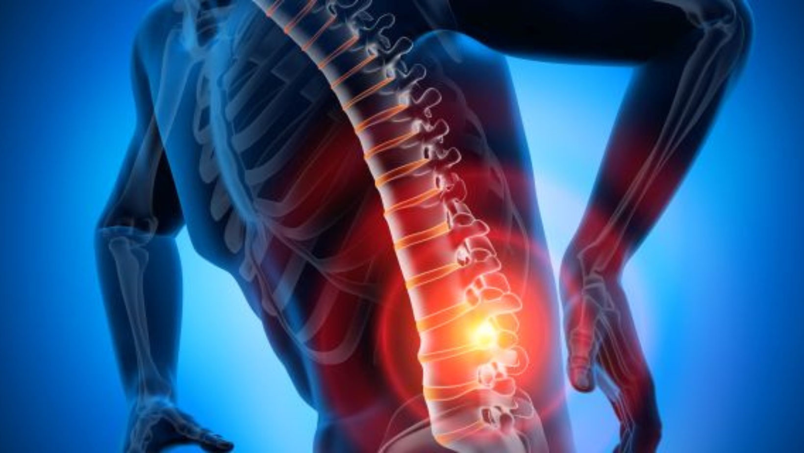 Hernia de disc - Cauze, Simptome, Tratament