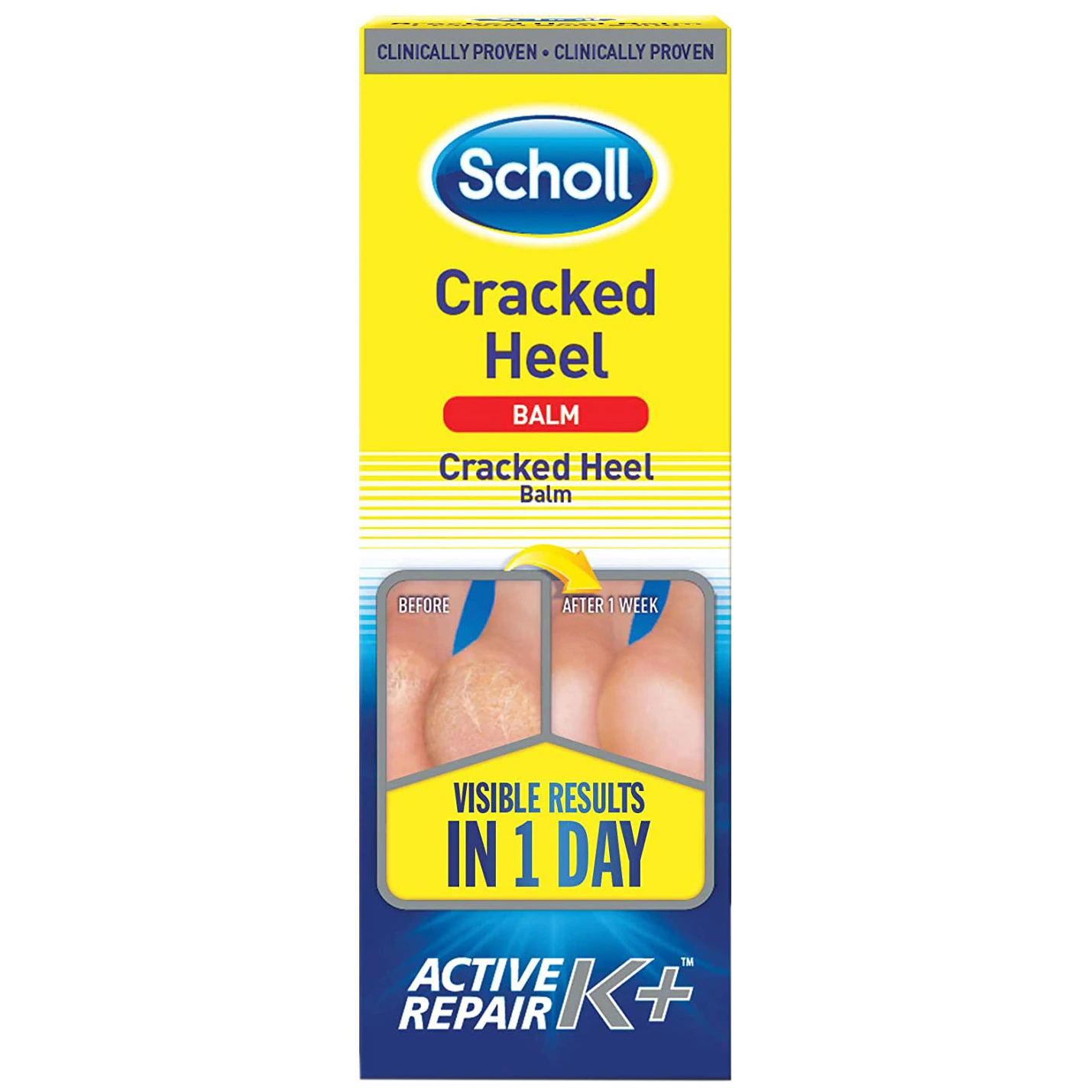 Hidratare corp - CREMA BALSAM CALCAIE CRAPATE UREE 60ML