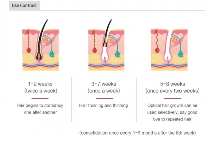 Epilator Premium IPL – Epilare Definitivă și Fără Durere Acasă [7]
