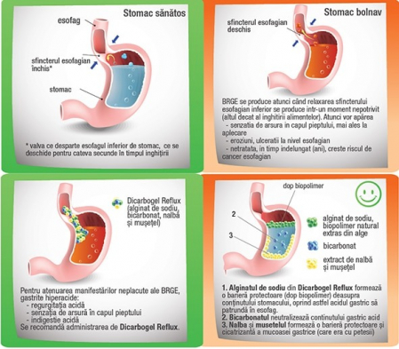 DIGASTROGEL REFLUX Arsuri gastrice si Indigestie acida, 30 comprimate masticabile, BioSunLine Helcor la Nana Plafar [1]
