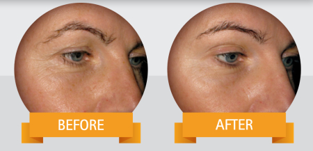 Qyra Collagen Anti-aging pentru ingrijire intensiva, 21 fiole buvabile, Gelita Health la Nana Plafar [2]