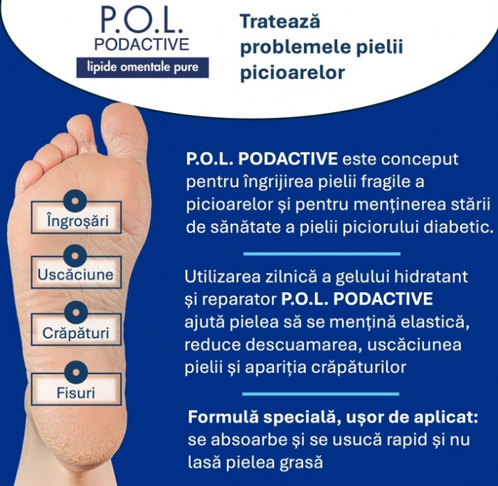 Cum sa-ti îngrijesti piciorul cu piele crapata si piciorul diabetic [3]