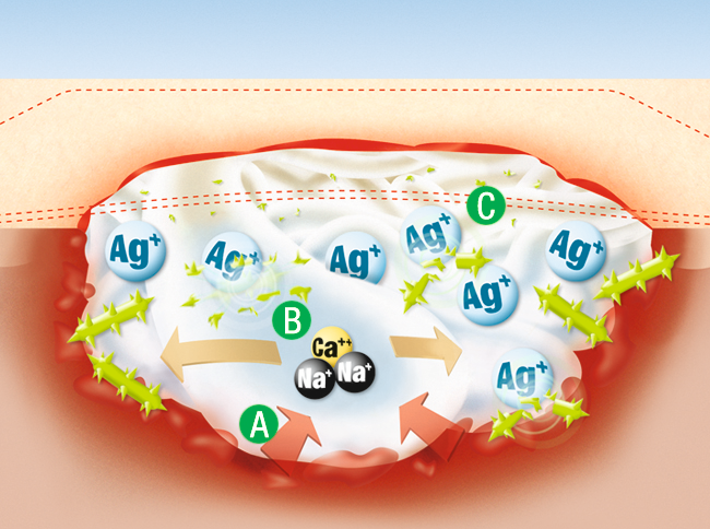 Suprasorb A+Ag Pansament, 10buc/cutie [3]