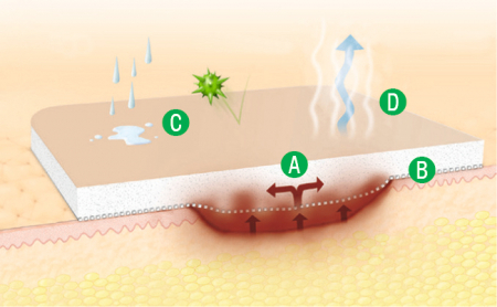 Suprasorb P Sensitive Silicone Foam Dressing non-border, 10buc/cutie [4]