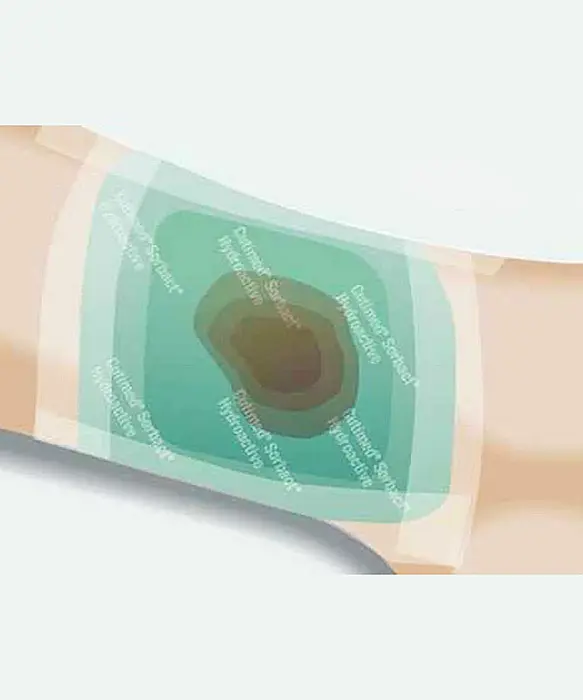Pansament antimicrobian Cutimed Sorbact Hydroactive [2]