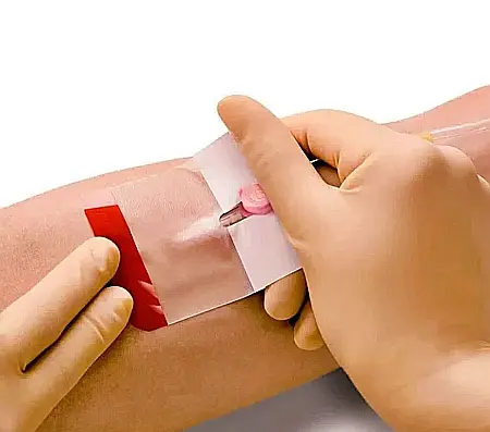 Plasturi transparenti fixare branula Leukomed IV film, cutie 50buc [2]
