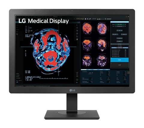 Monitoare - Monitor LG 24" 24HR513C-B.AEU