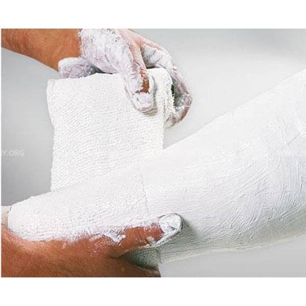 Fasa gipsata 20 cm x 3 m Safix Plus [4]