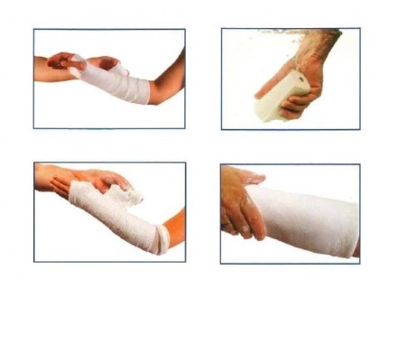Fasa gipsata 10 cm x 3 m Safix Plus [1]