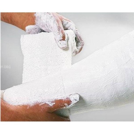 Fasa gipsata 20 cm x 3 m Safix Plus [3]