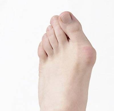 Orteza pentru Hallux Valgus profesionala [4]