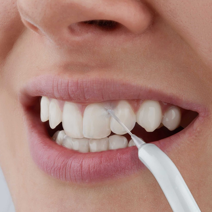 IRIGATOR BUCAL 5 CAPETE REZERVOR 150ML SENCOR [7]