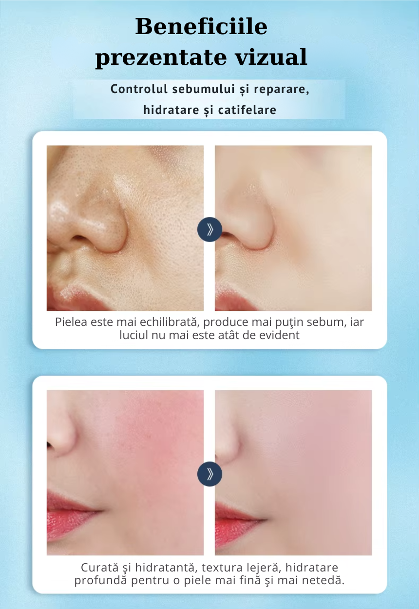 Set îngrijire ten E’YEARN (7 piese) – Hidratare, anti-acnee, puncte negre, anti-aging [7]