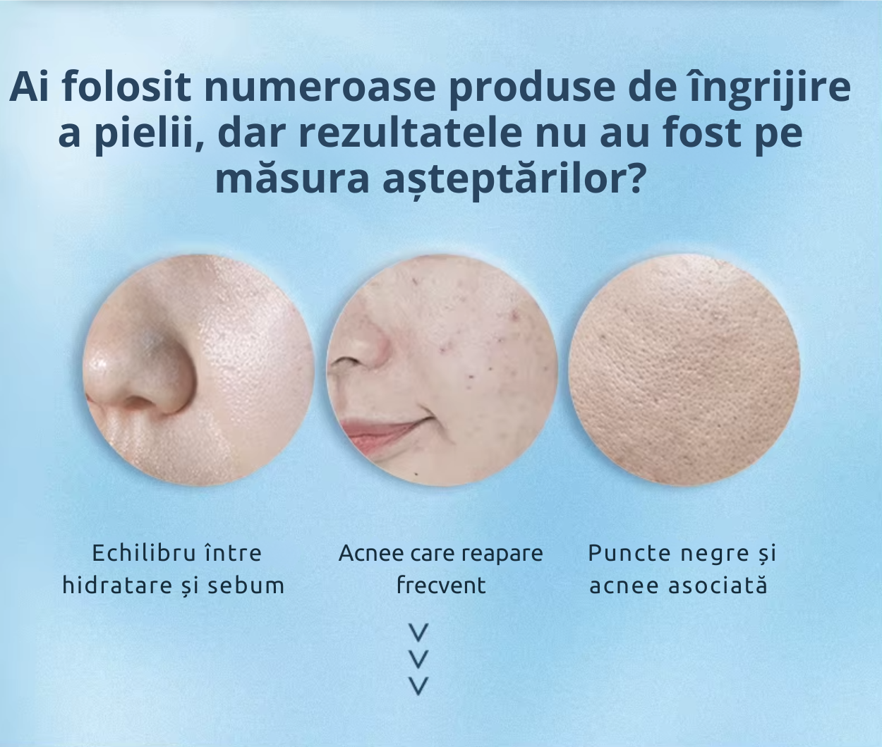 Set îngrijire ten E’YEARN (7 piese) – Hidratare, anti-acnee, puncte negre, anti-aging [6]