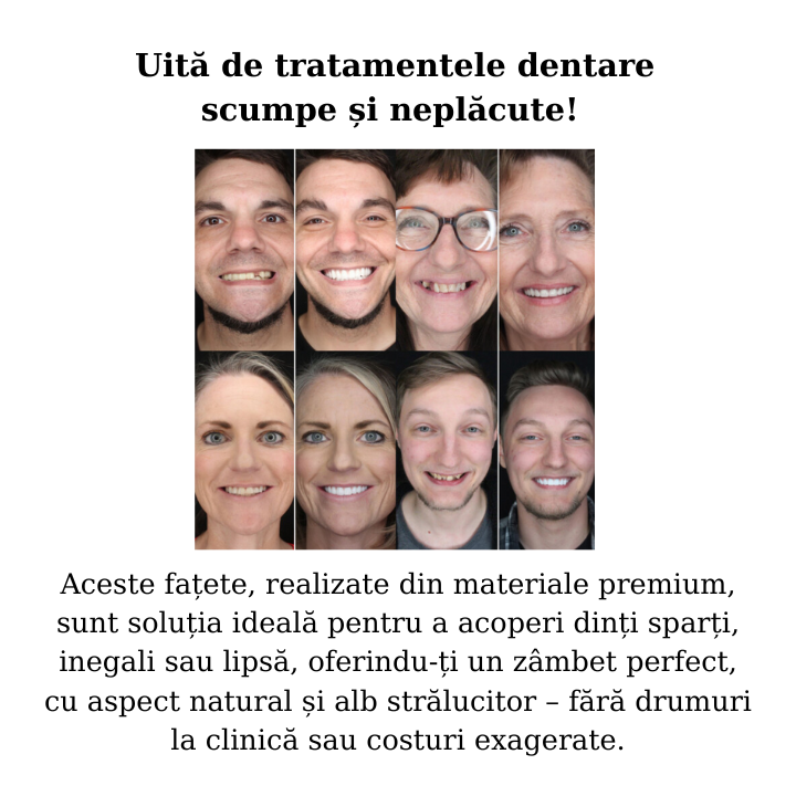 SnapSmile
