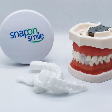 Fațete Dentare Cosmetice SnapSmile – Kit Complet pentru Zâmbet Alb Instant [8]