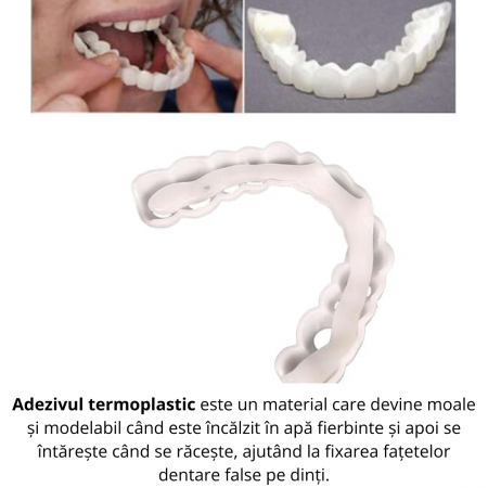 Fațete Dentare Cosmetice SnapSmile – Kit Complet pentru Zâmbet Alb Instant [1]