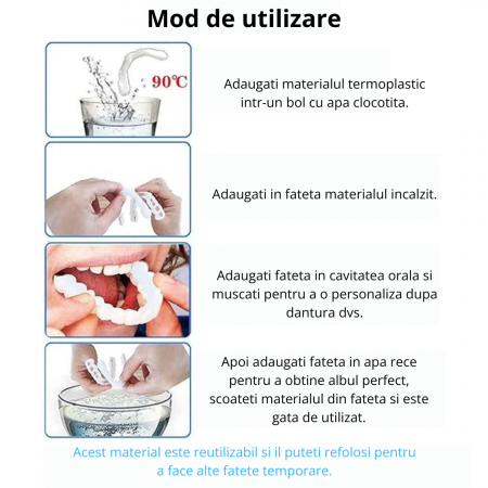 Fațete Dentare Cosmetice SnapSmile – Kit Complet pentru Zâmbet Alb Instant [2]