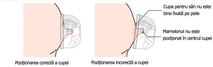Set Cupe Hands Free (28 mm) [5]