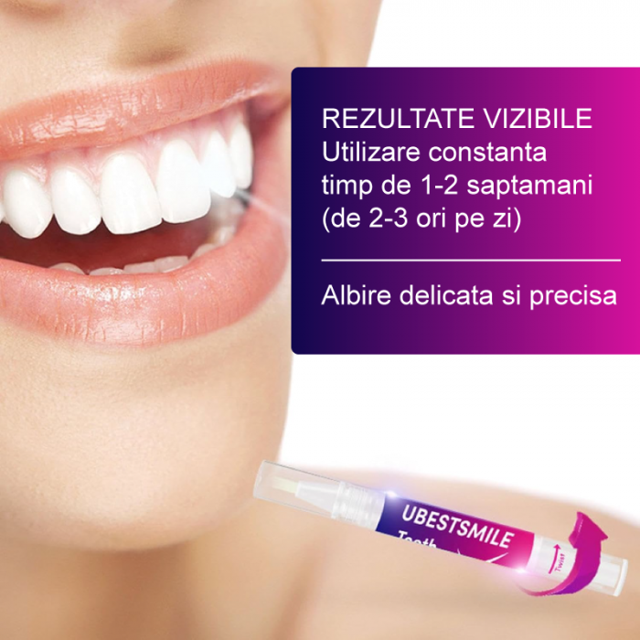 Gel Pentru Albirea Dintilor Premium SUPER TRENDS®, Indeparteaza Petele, Extract de Menta, Forma Creion, 1 Buc [5]