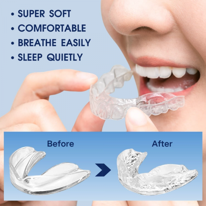 Set de 4 Gutiere Bruxism Premium SUPER TRENDS®, Aparatoare Dentara Pentru Somn, 4 Piese Modelabile, Opreste Scrasnitul Din Dinti, Husa de Calatorie [6]