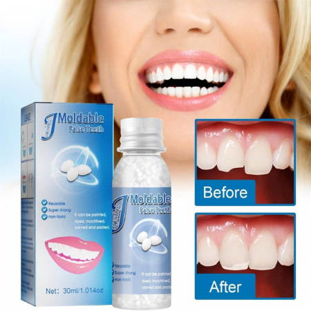Kit de Reparare Temporara a Dintilor Profesional SUPER TRENDS®, Granule Pentru Reparatii Dentare, Bilute Reutilizabile, Non Toxic, 30 ml [6]
